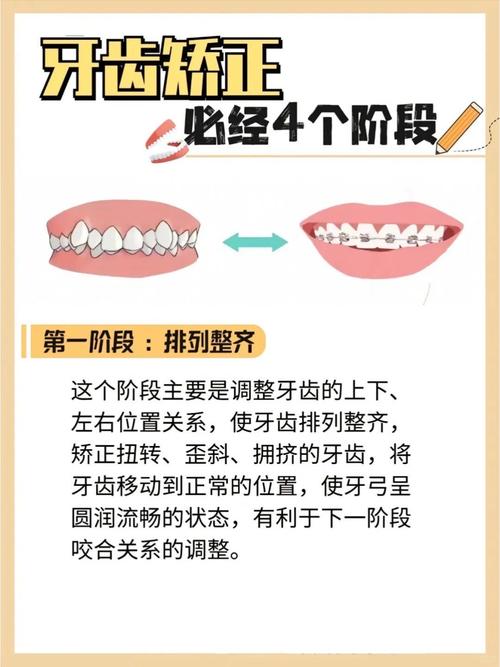 牙齿矫正会影响家居风水布局吗？