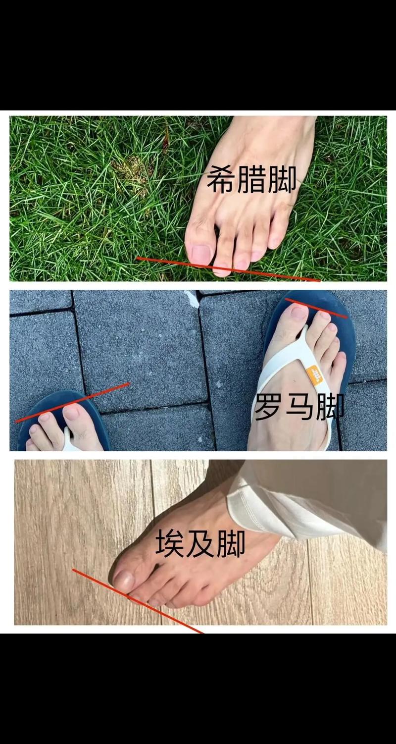 大脚趾和二脚趾一样长，这样的脚型命运如何？