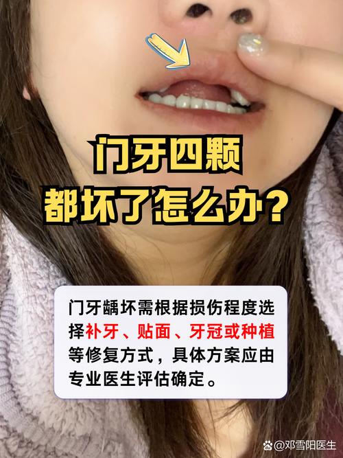 门牙损坏对家居风水有影响吗？