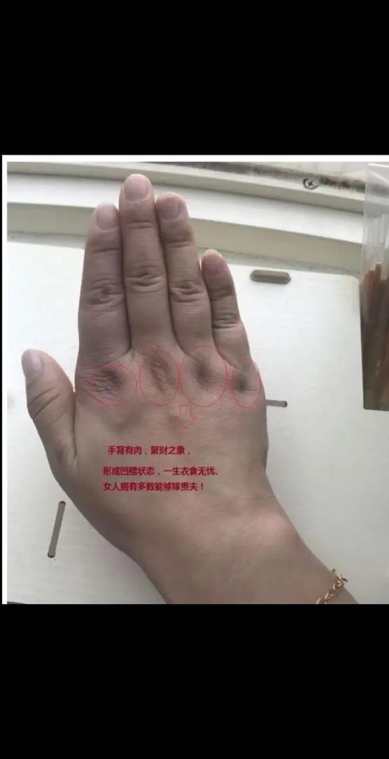 手背褶皱多是否意味着命运多舛？