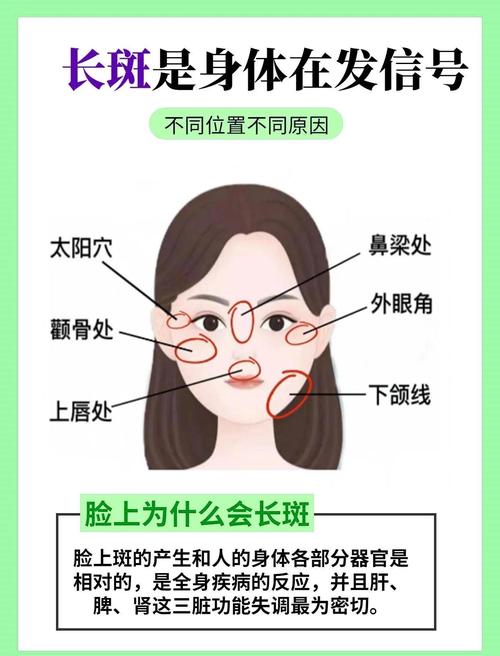 脸上雀斑会对家宅风水产生怎样的影响？