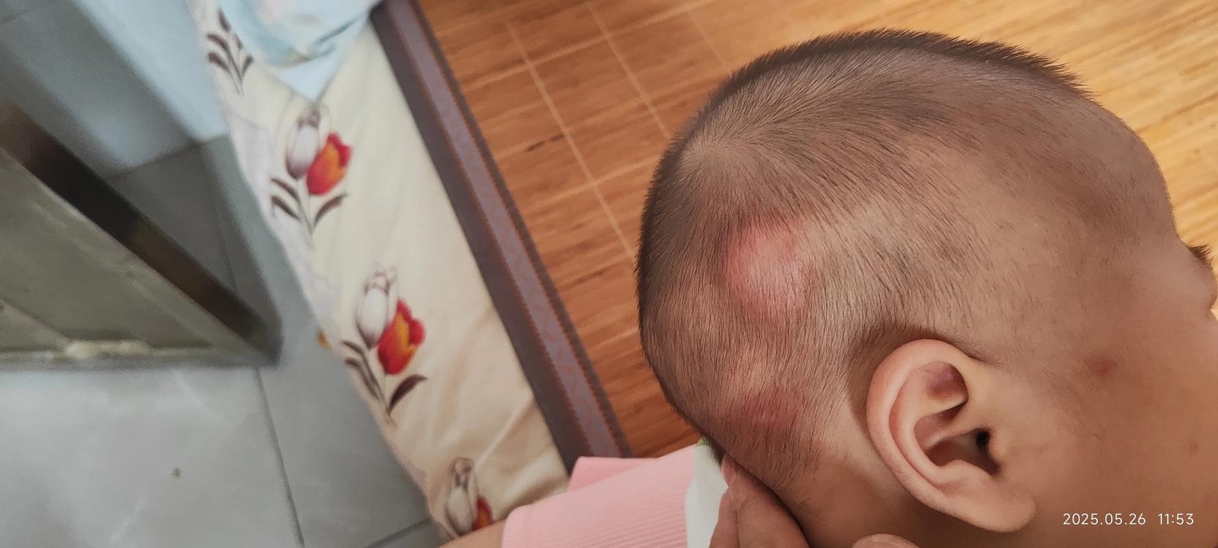 天生头顶硬包是何命运？几月份出生的女孩子天生享福？