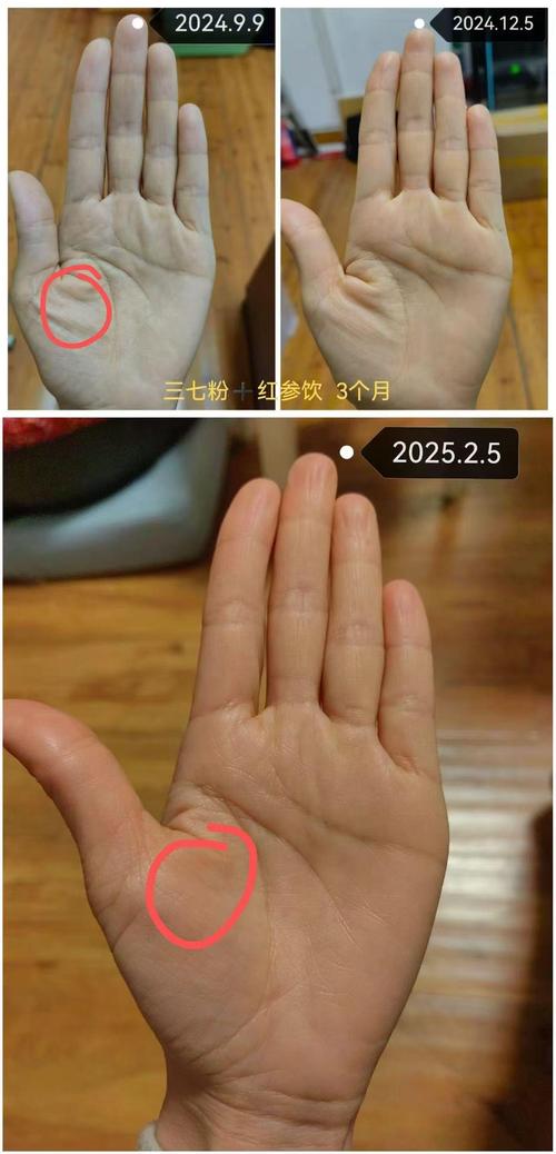 手掌偏黄偏硬预示着怎样的命运？手掌黄意味着什么？