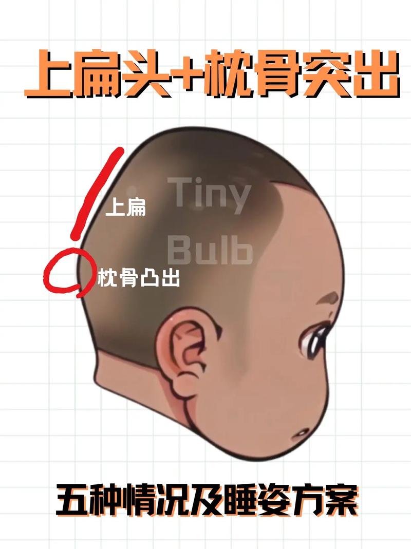 枕骨凸起的人命运如何？