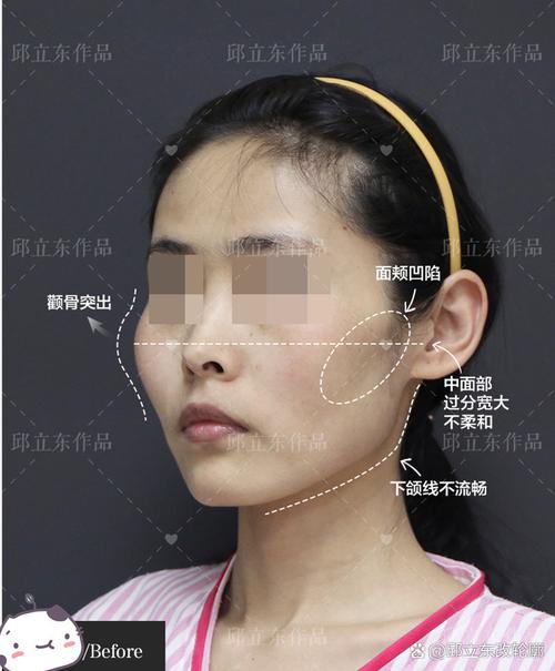 没下巴脸型命运如何？颧骨突出脸型命运怎样？