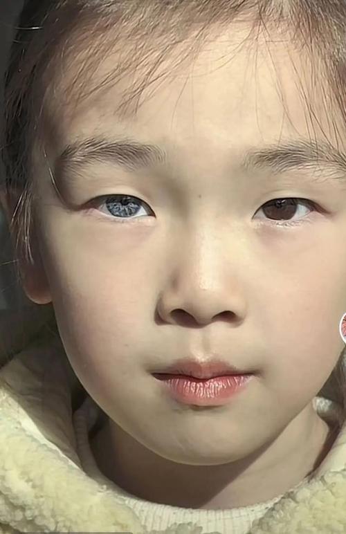 童子命的人眼部有哪些显著特征？