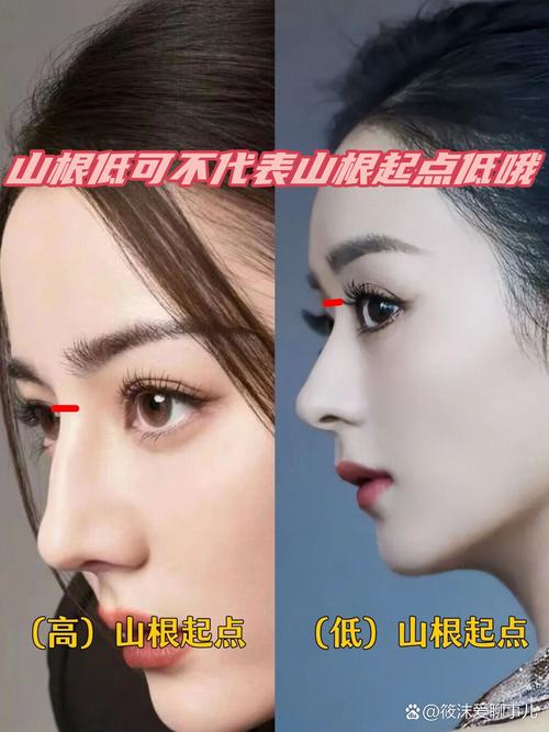 鼻子短山根矮是何命？鼻子高但山根低面相如何改？