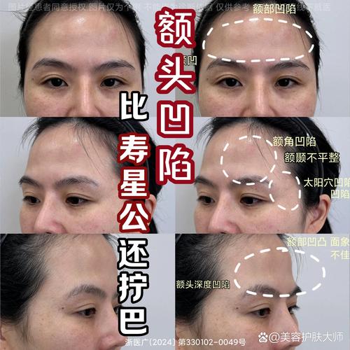 额头凸的人命运如何？额头凸的人运势如何？