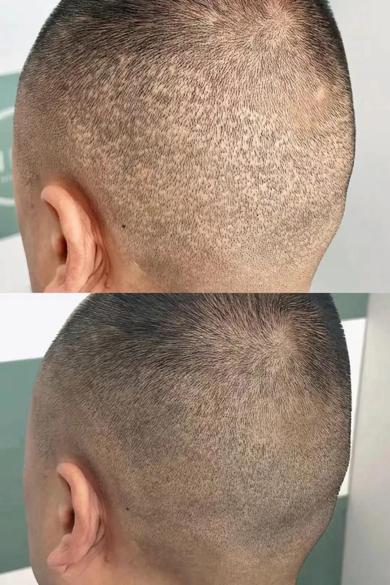 纹发际线对家居风水有影响吗？