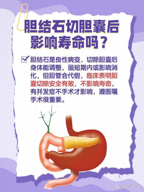 胆管结石风水问题严重吗，会对日常生活和健康造成哪些影响？