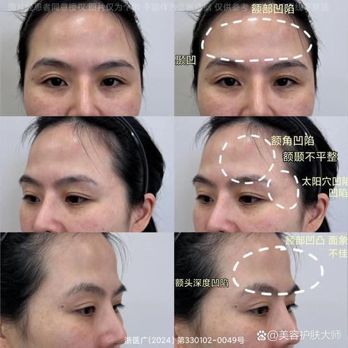 额头凸的人命运如何？额头凸的人运势如何？