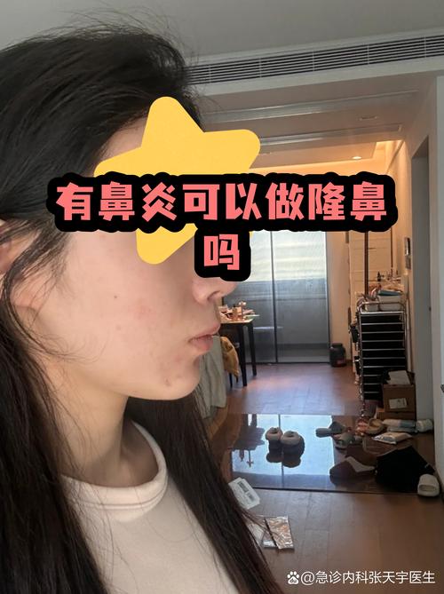 做鼻子手术会对家居风水产生怎样的影响？