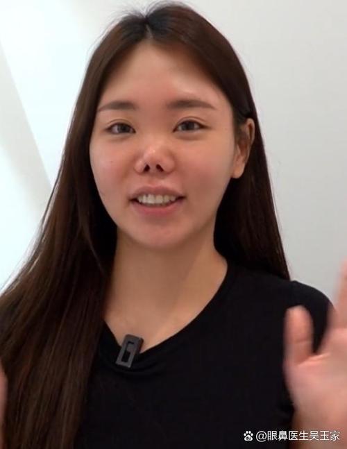 女人鼻子畸形命运如何？鼻大嘴小女人命理怎样？