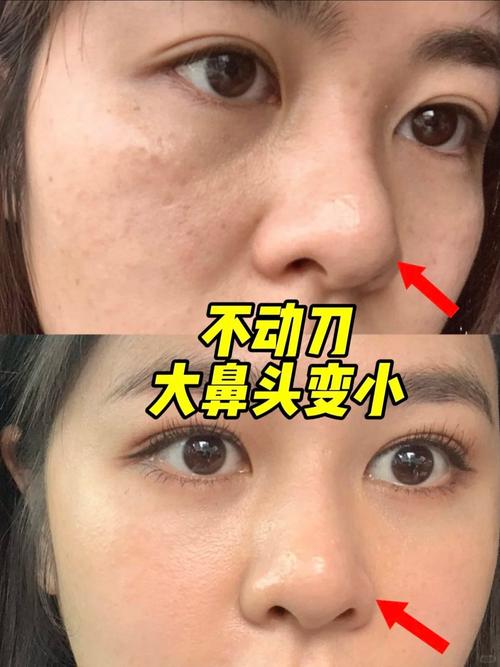 脸大鼻小的人命运如何？女人面相脸大鼻子小改命方法有哪些？