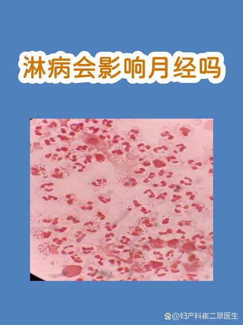 家里风水对妇科健康有影响吗？