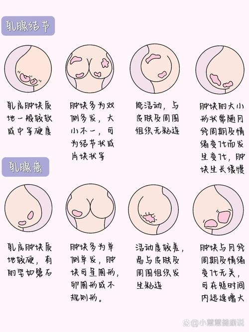 女人圆形奶和乳头内陷，命运是否注定多舛？