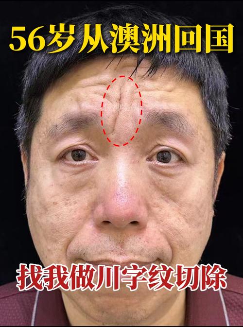 脸上动刀手术会对家宅风水产生怎样的影响？