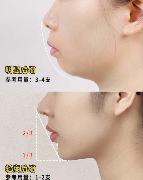 下巴太小的女人命运如何？男人下巴小又代表什么命运？