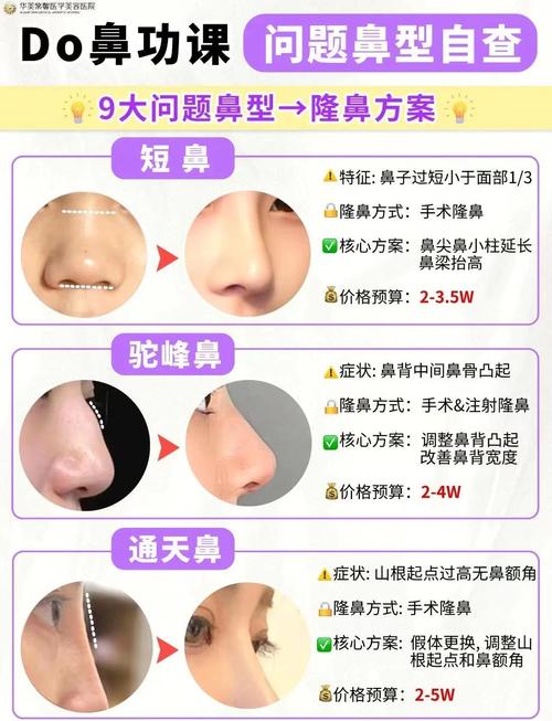 做过鼻子手术会影响家居风水布局吗？