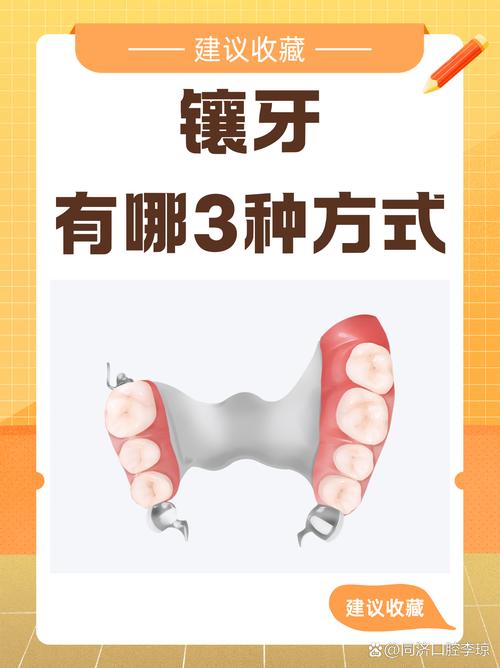 镶牙会对家居风水产生哪些具体影响？