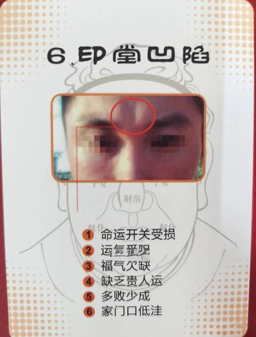 男人印堂凹陷命运如何，有何破解方法？