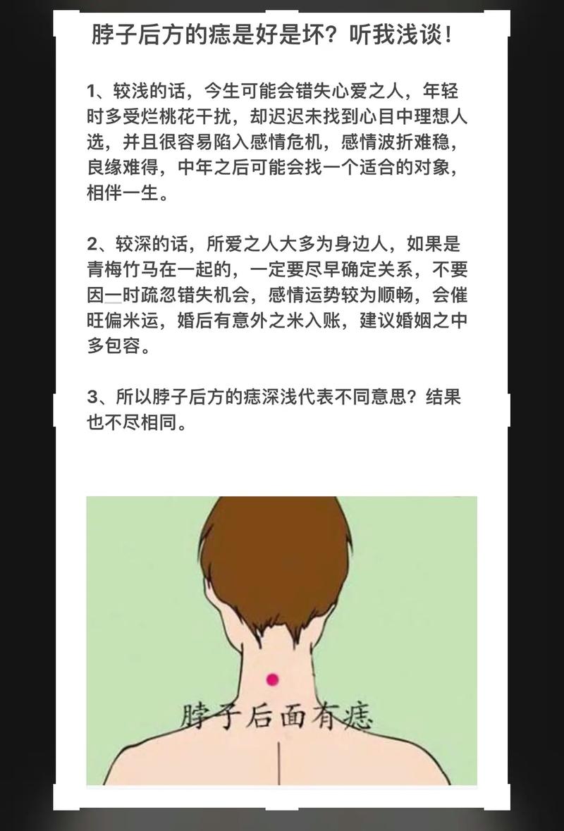 脖子后头长瘊子命运如何？后脖颈有痦子有何说法？