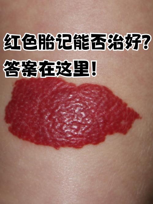 脚上红色胎记预示着怎样的命运？老说法中脚上红胎记的寓意是什么？