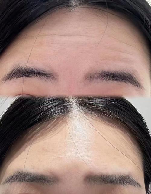 脸部填充会对女生风水运势产生什么影响？