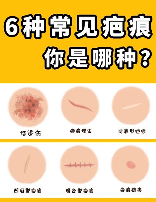 身上疤痕多，难道是前世留下了哪些痕迹的暗示？