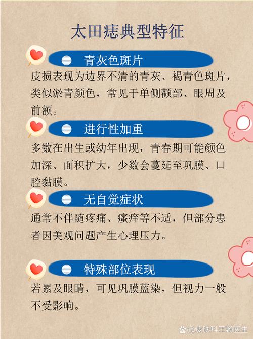 太田痣的形成与风水学说之间是否存在关联？