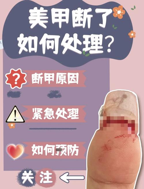 指甲断裂是否会对家居风水产生不良影响？