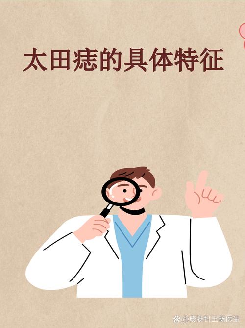 太田痣的形成与风水学说之间是否存在关联？