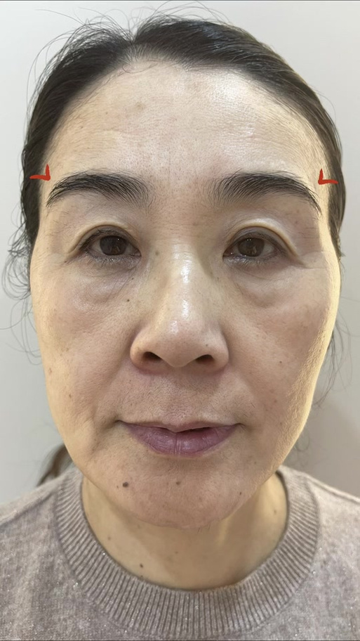 眼窝深陷的女人命理如何，这种面相好不好？