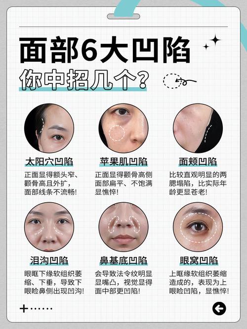 额头中间凹陷代表什么命运？如何改善额头不平的运势？