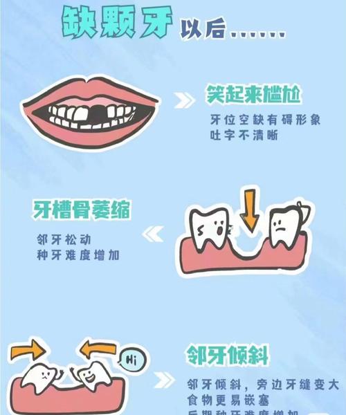 大牙缺失是否会对家庭风水产生不良影响？