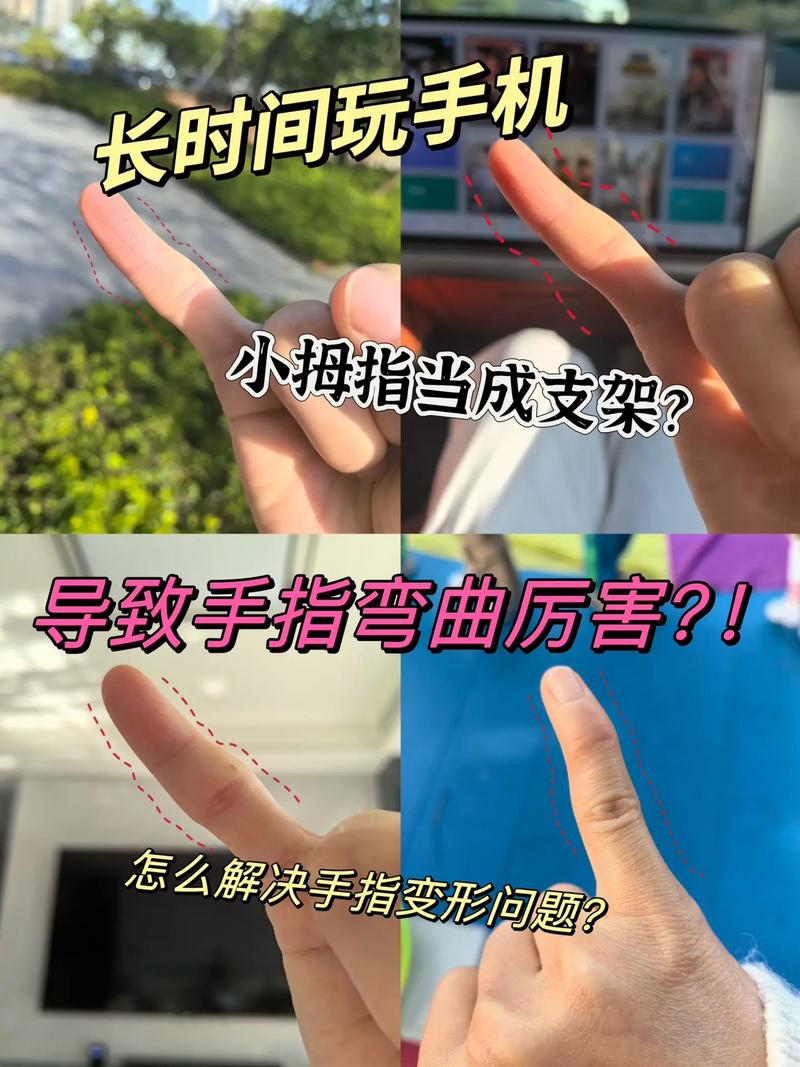 不拐弯的人手指弯曲命运如何改写？