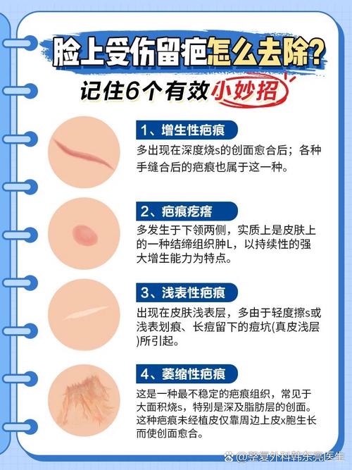 哪种命格容易留下疤痕，如何改写命格避免留下疤痕？