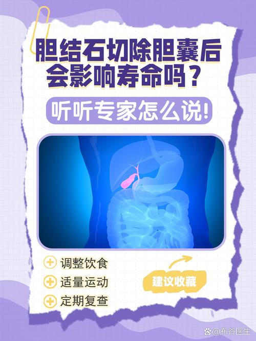 胆管结石风水问题严重吗，会对日常生活和健康造成哪些影响？