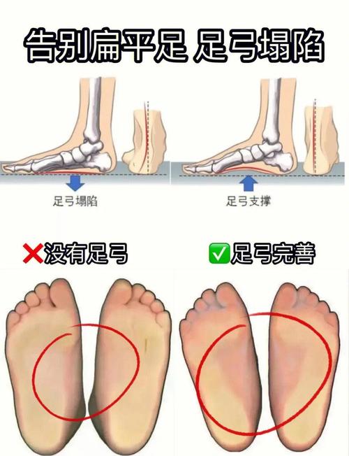 脚掌宽的小孩和脚板宽的女人命运如何？