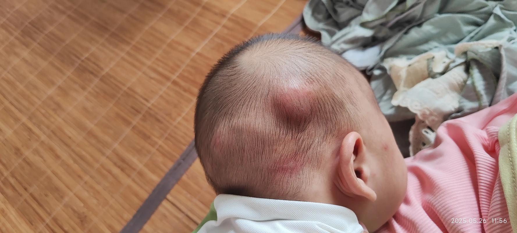 天生头顶硬包是何命运？几月份出生的女孩子天生享福？