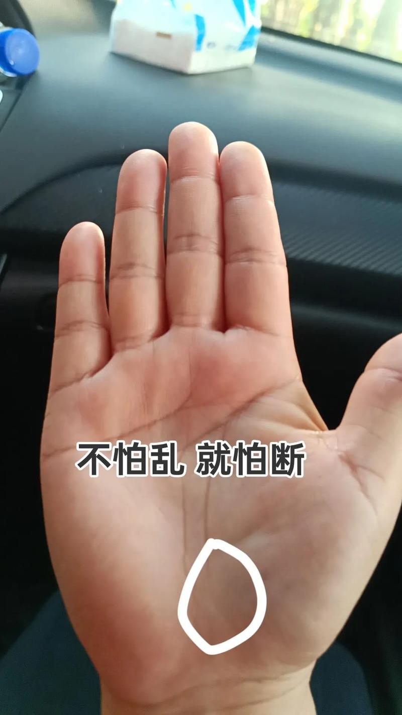 手相断裂预示着什么命格？这是否意味着命运将有重大转折？