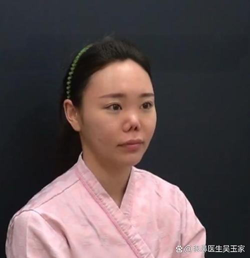 女人鼻子畸形命运如何？鼻大嘴小女人命理怎样？