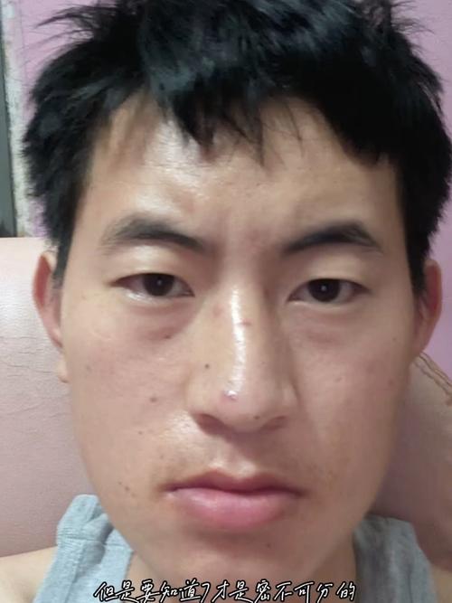 男人脸瘦凹进去的面相是穷命吗？