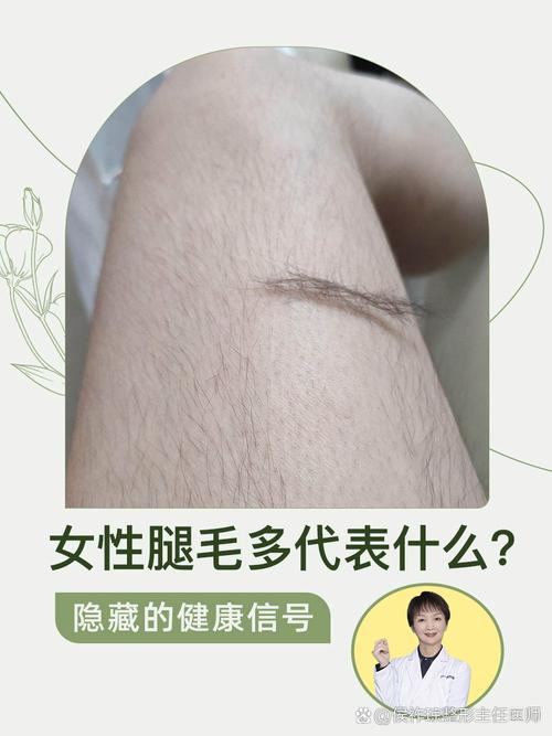 女人腿毛多，是命运不好预示吗？