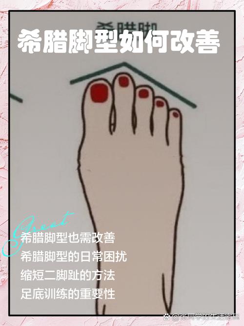 女人希腊脚命运如何？希腊脚有哪些独特好处？