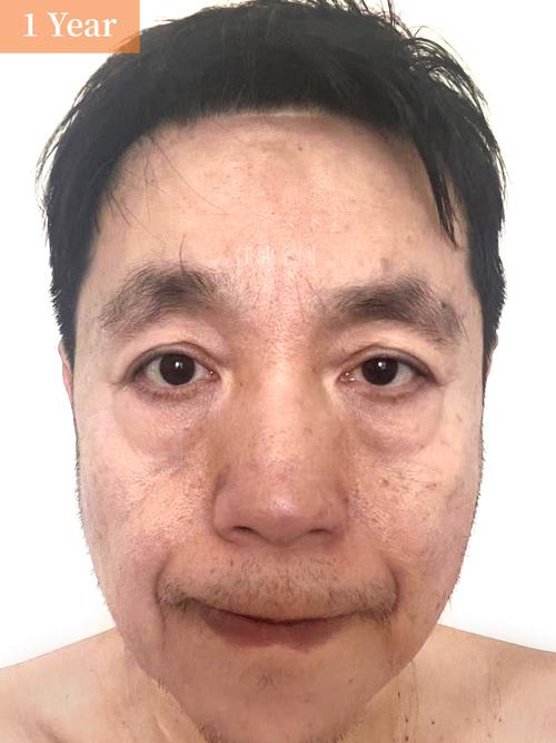 脸上动刀手术会对家宅风水产生怎样的影响？