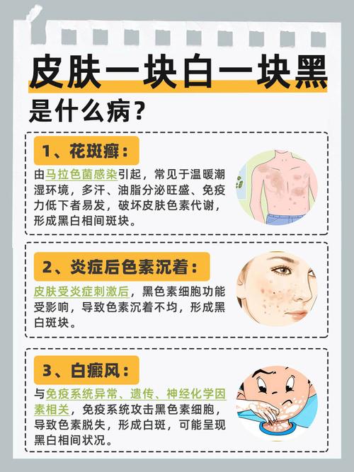 手脚白脸黑是何命？脸黑身白属何面相？