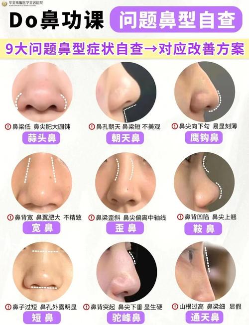 做过鼻子手术会影响家居风水布局吗？