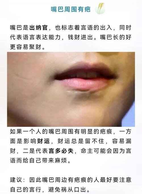 嘴巴受伤对家居风水有影响吗？