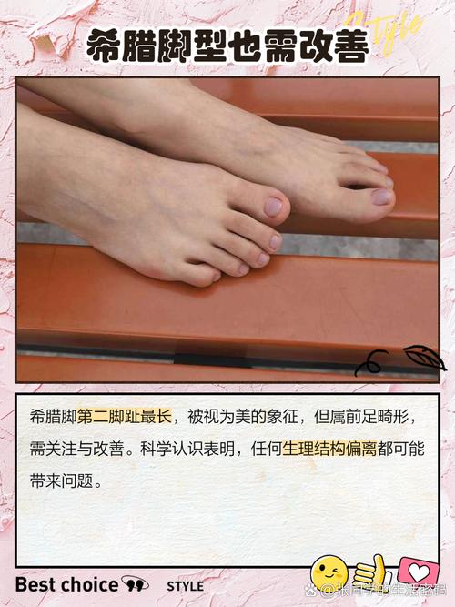 女人希腊脚命运如何？希腊脚有哪些独特好处？